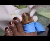Foot and toe treatment