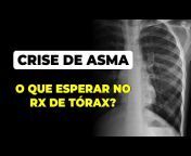 Raios X de Tórax em Pediatria - Dr Cláudio Amorim
