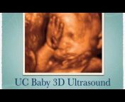 UC Baby 3D Ultrasound
