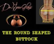 The round shape is one of the most commonly seen buttock shapes in my clinic. But what is the round-shaped buttock? It is an anatomical variation where, if we draw a line through the middle third of the buttock, this area seems to be bulging out significantly and deviates from the hourglass-shaped buttock. If we compare the hourglass shape and the round shape, you can tell that there is a lot of similarity, except that the round shape increases the horizontal as well as the vertical dimension of
