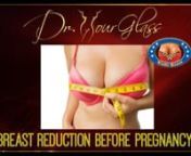 Hi, this is Dr. Hourglass, and welcome to another video in our channel Wonder Breasts. Today we are going to discuss: Breast reduction before pregnancy.In this channel we discuss everything related to breast surgery.nWelcome back!Many patients looking for the breast reduction procedure are quite young and have plans to give birth in the future. A question that commonly arises with these types of patients is if they should have the procedure done before pregnancy. In other words, they are w