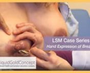 In Case 1.5, we demonstrate how to use the LiquidGoldConcept Lactation Simulation Model (LSM) to teach patients and health providers hand expression of colostrum into a spoon.nnClick here to watch Case 1.6 Breastfeeding Plan on Day 3 Postpartum: https://www.youtube.com/watch?v=hJrhZaiYpmInnVisit us at https://liquidgoldconcept.com/ to learn more about the Lactation Simulation Model