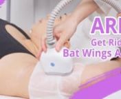Arm Slimming &#124; Fat Freezing Weight Loss/ Fat Reduce Slimming / Body Sculpturing &#124; 7008CB myChway nnBUY IT NOW: https://shop.mychway.com/itm/WL-7008CB.htmlnnToned, well-defined upper arms, who do not wanna get?nSpeaking of bat wings, especially for girls, it is difficulty work,nonce you have bat wings, it means that you have to say byebye to these beautiful clothes,nsuch as shirts with fitted sleeves, even make you feel self-conscious about wearing sleeveless tops.nThe only way is to wear those r