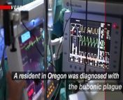 Health officials announced a resident in Oregon was diagnosed with the bubonic plague, marking the state&#39;s first human case in more than eight years.