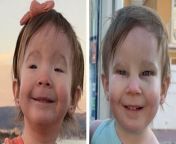 A toddler born visually impaired due to a rare condition can see clearly for the first time thanks to corrective surgery.&#60;br/&#62;&#60;br/&#62;Lily Etherton, two, suffers from Blepharophimosis Ptosis Epicanthus Inversus Syndrome (BPES), which means she couldn&#39;t open her eyes fully.&#60;br/&#62;&#60;br/&#62;Lily&#39;s condition meant she had droopy eyelids, smaller than average eye openings and an upward fold of the inner lower eyelid.&#60;br/&#62;&#60;br/&#62;As she grew older, the condition made it difficult for Lily to move, walk and function. &#60;br/&#62;&#60;br/&#62;She&#39;d fall easily or bump into things, often hurting herself. &#60;br/&#62;&#60;br/&#62;Last month, Lily was operated on and underwent a frontalis flap surgery, which aimed at opening her eyes so she could see properly.&#60;br/&#62;&#60;br/&#62;Lily&#39;s surgery was a resounding success and the tot is now &#92;