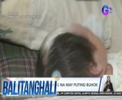 Sanggol pa lang, pero may uban o puting buhok na?&#60;br/&#62;&#60;br/&#62;&#60;br/&#62;Balitanghali is the daily noontime newscast of GTV anchored by Raffy Tima and Connie Sison. It airs Mondays to Fridays at 10:30 AM (PHL Time). For more videos from Balitanghali, visit http://www.gmanews.tv/balitanghali.&#60;br/&#62;&#60;br/&#62;#GMAIntegratedNews #KapusoStream&#60;br/&#62;&#60;br/&#62;Breaking news and stories from the Philippines and abroad:&#60;br/&#62;GMA Integrated News Portal: http://www.gmanews.tv&#60;br/&#62;Facebook: http://www.facebook.com/gmanews&#60;br/&#62;TikTok: https://www.tiktok.com/@gmanews&#60;br/&#62;Twitter: http://www.twitter.com/gmanews&#60;br/&#62;Instagram: http://www.instagram.com/gmanews&#60;br/&#62;&#60;br/&#62;GMA Network Kapuso programs on GMA Pinoy TV: https://gmapinoytv.com/subscribe