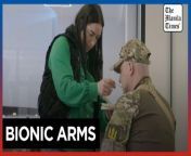 Decorated &#39;Hero of Ukraine&#39; learns to live with bionic arms&#60;br/&#62;&#60;br/&#62;Valeriy Kucherenko, a decorated &#92;